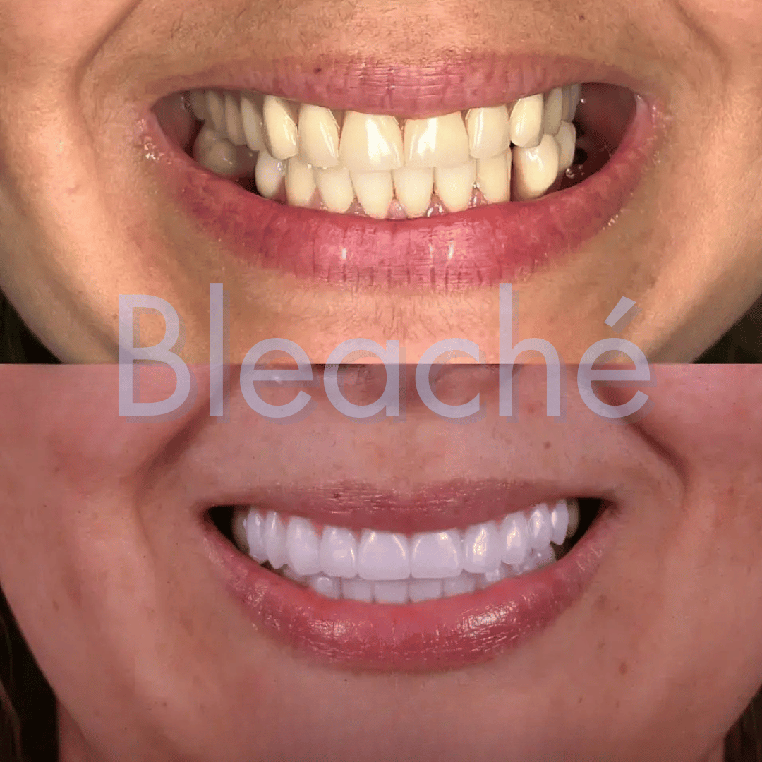 Bleaché Powder