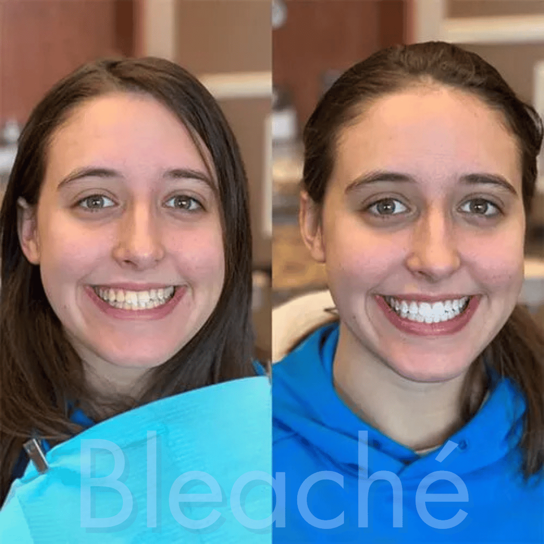 Bleaché Powder