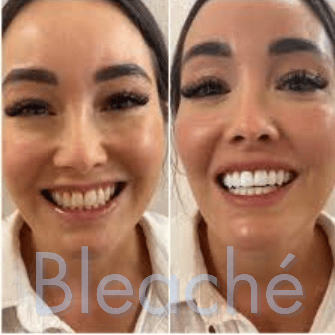 Bleaché Powder