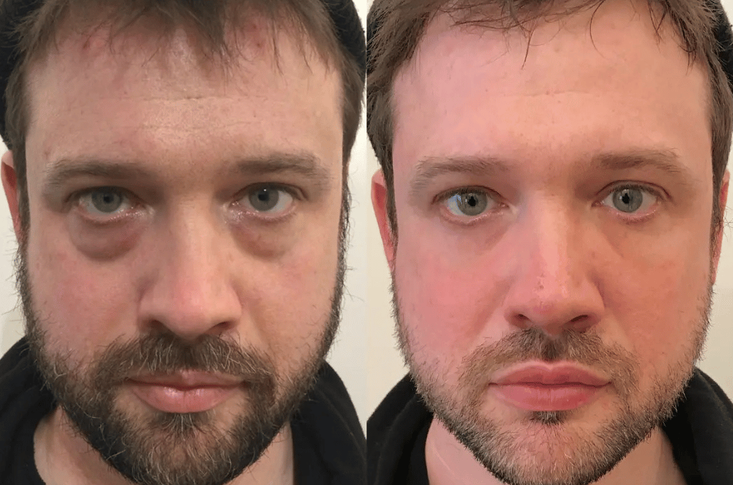 Peter, Thomas - Extreme Instant Eye Firming Serum