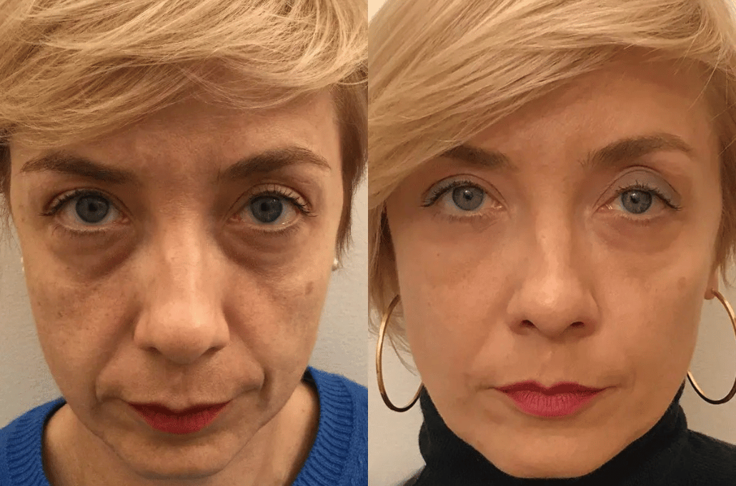 Peter, Thomas - Extreme Instant Eye Firming Serum