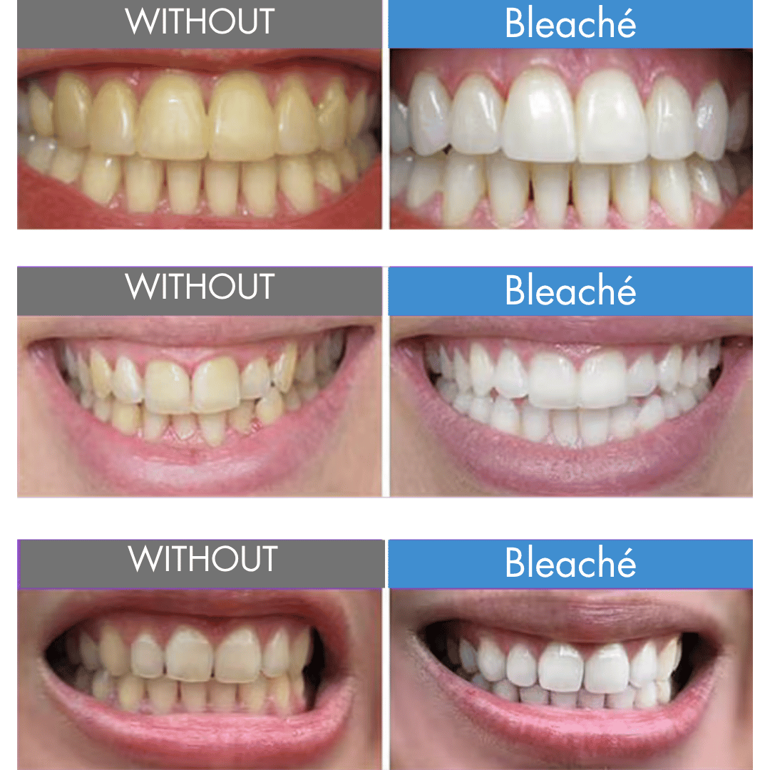 Bleaché Powder