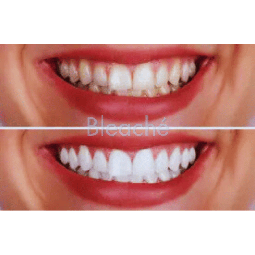Bleaché Powder