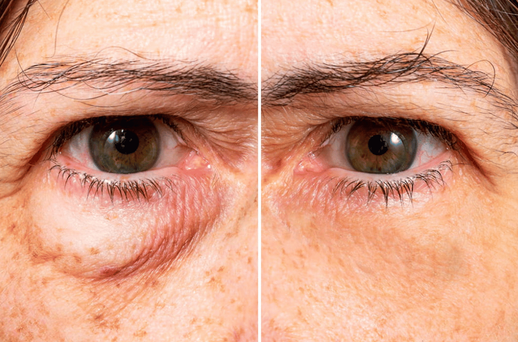 Peter, Thomas - Extreme Instant Eye Firming Serum
