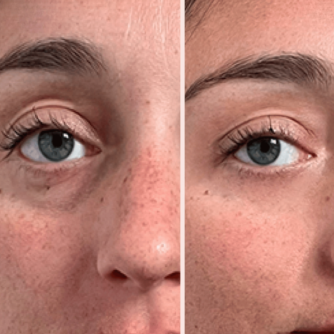 Peter, Thomas - Extreme Instant Eye Firming Serum