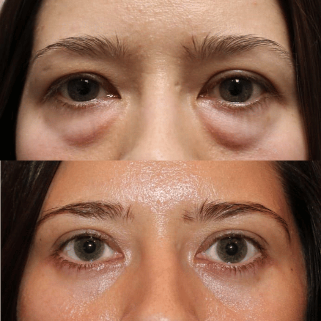 Peter, Thomas - Extreme Instant Eye Firming Serum