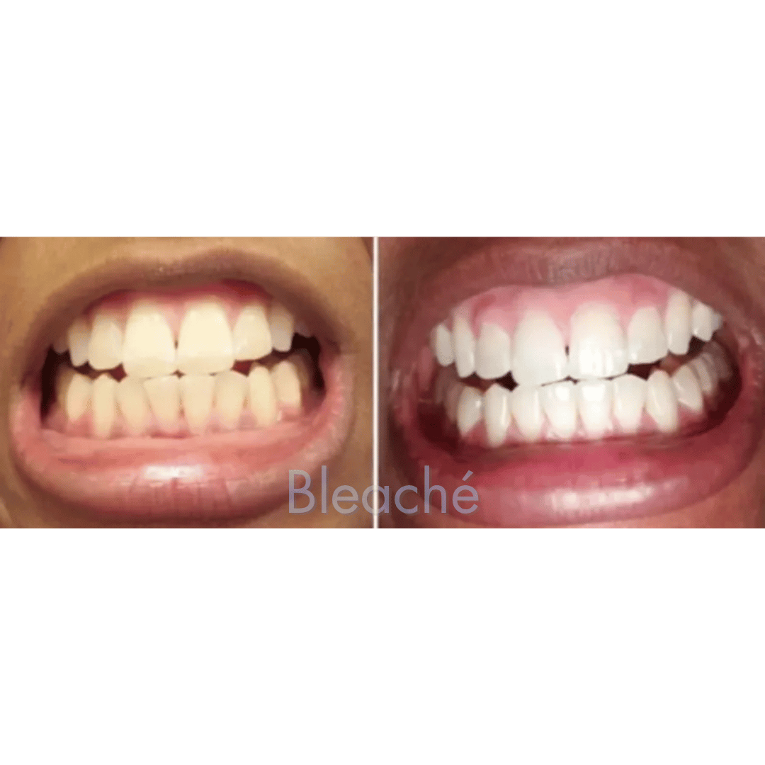 Bleaché Powder