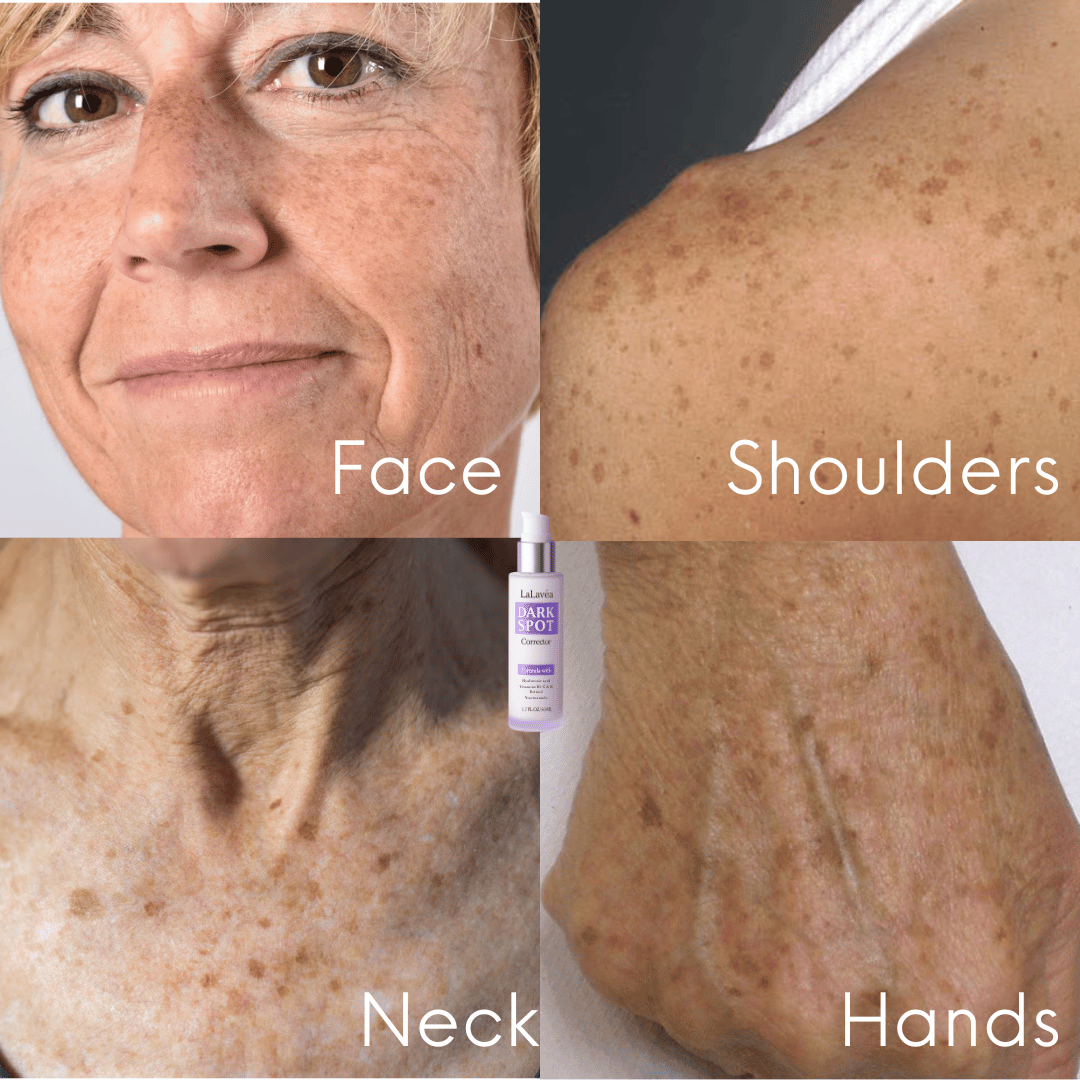 LaLavéa Darkspot-Corrector