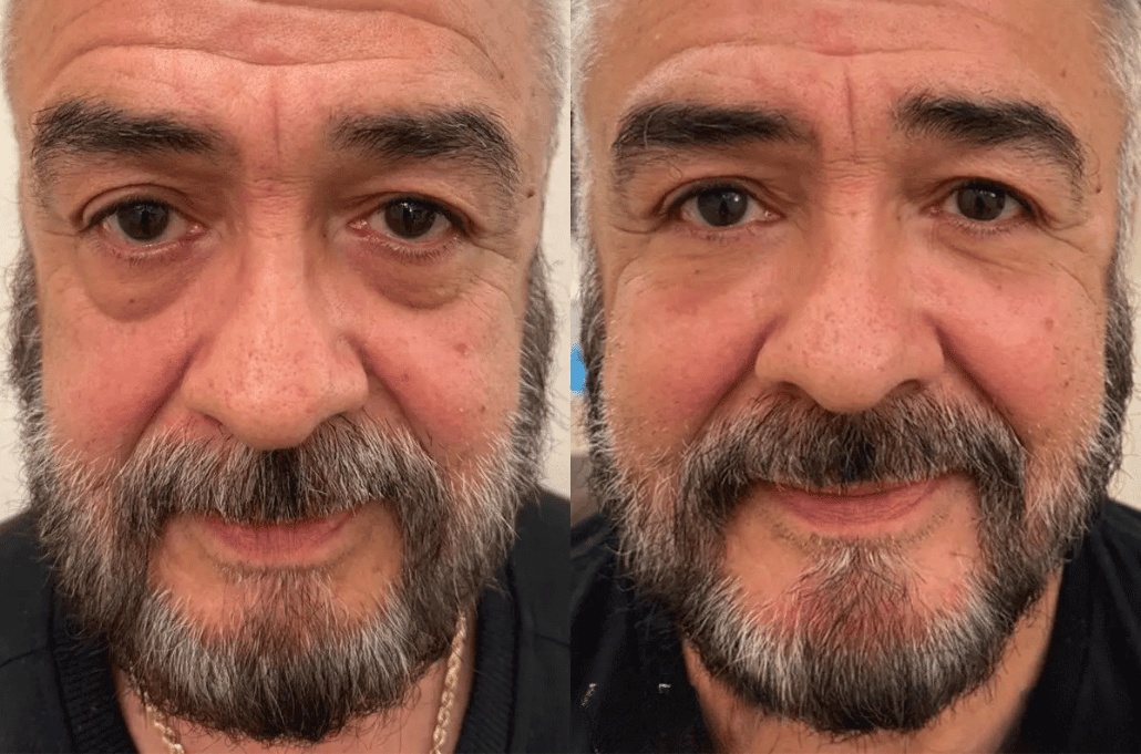 Peter, Thomas - Extreme Instant Eye Firming Serum