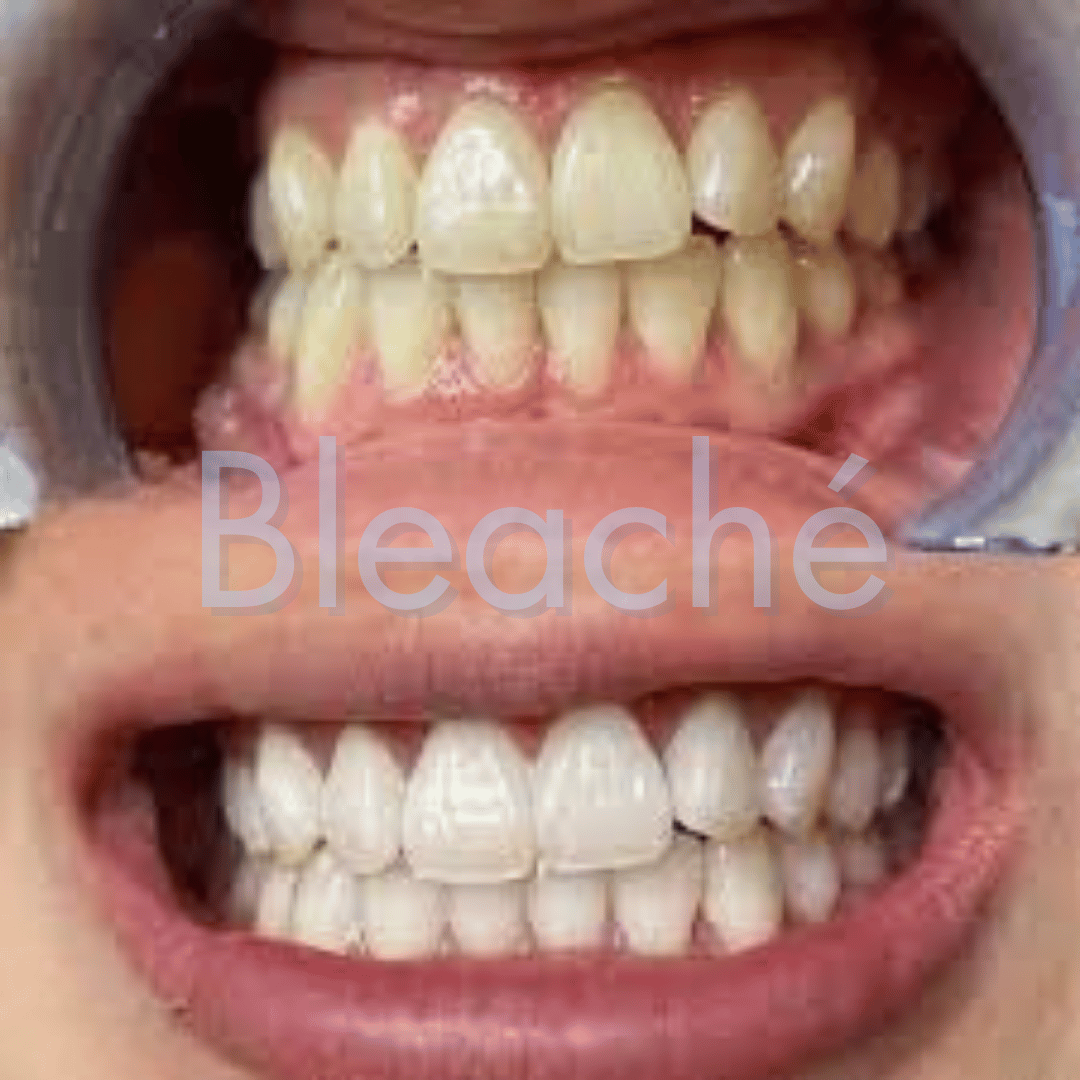 Bleaché Powder