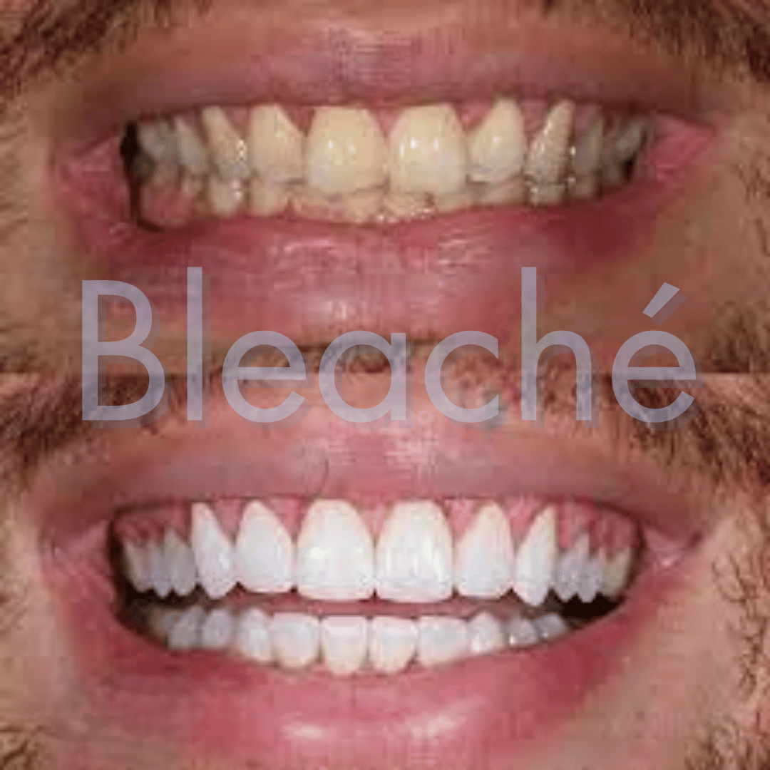 Bleaché Powder