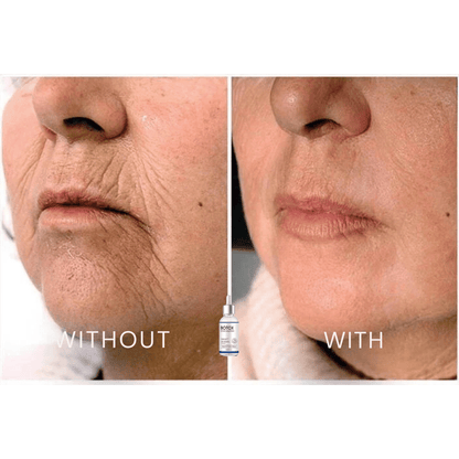 Samui | FACELIFT Botoxserum C
