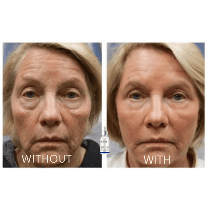 Samui | FACELIFT Botoxserum C