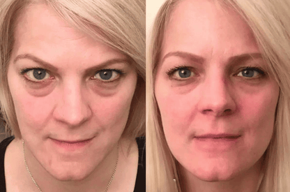 Peter, Thomas -  Extreme Instant Eye Firming Serum