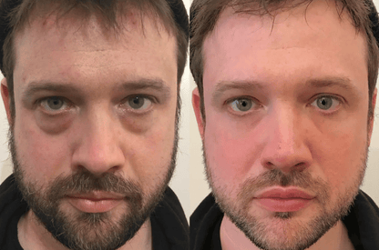 Peter, Thomas -  Extreme Instant Eye Firming Serum
