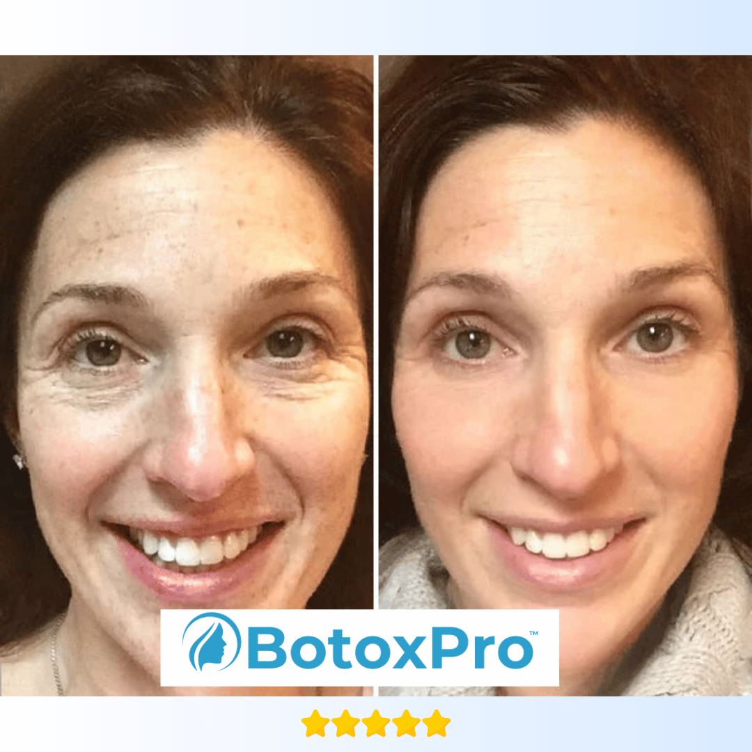 BotoxPRO Serum