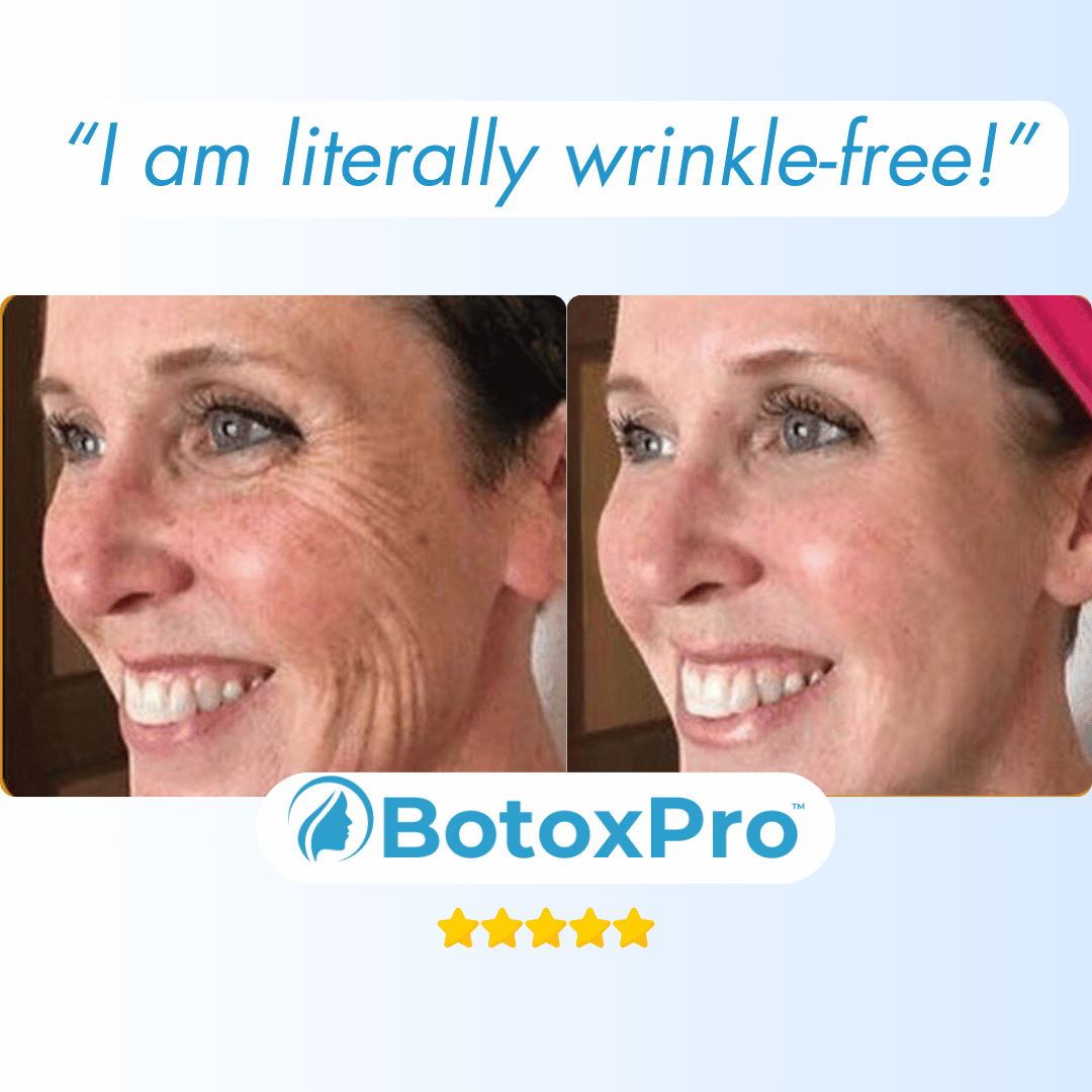 BotoxPRO Serum