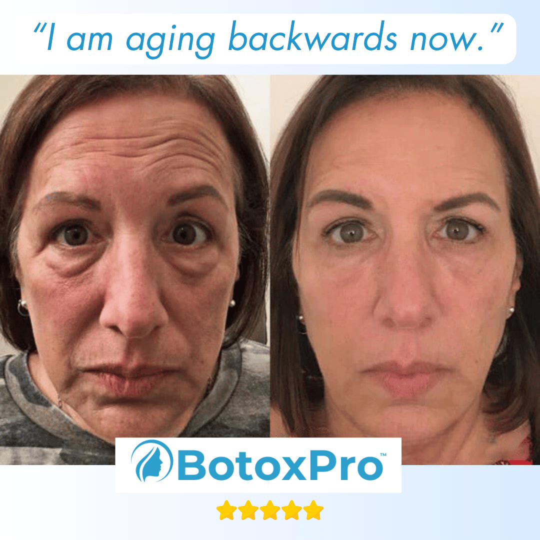 BotoxPRO Serum