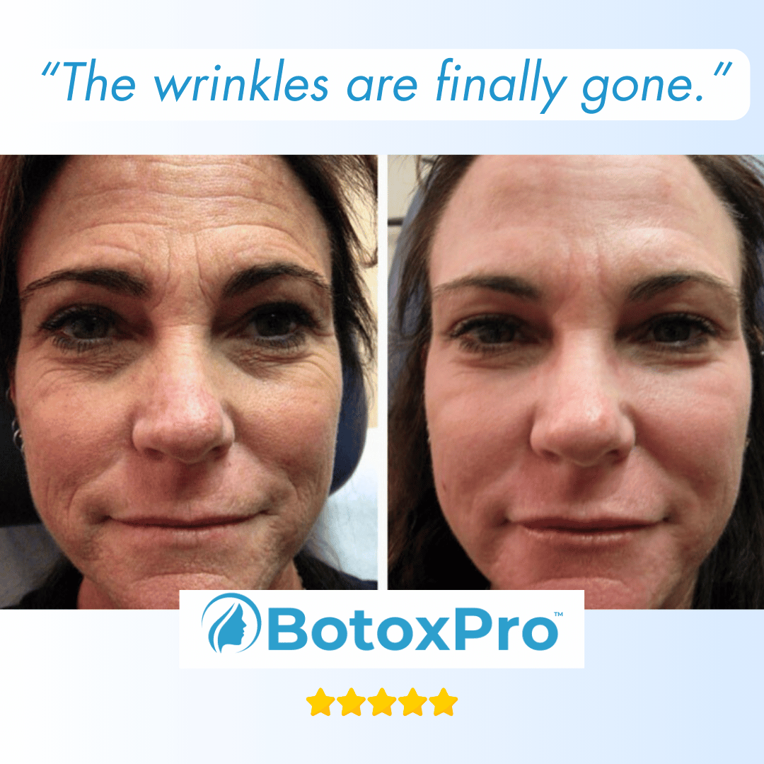 BotoxPRO Serum