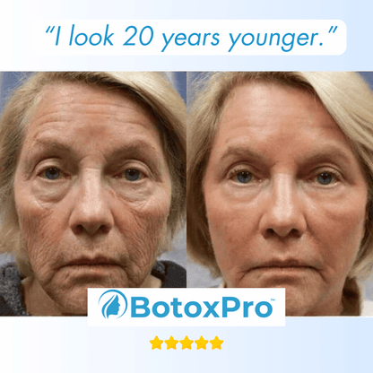 BotoxPRO Serum