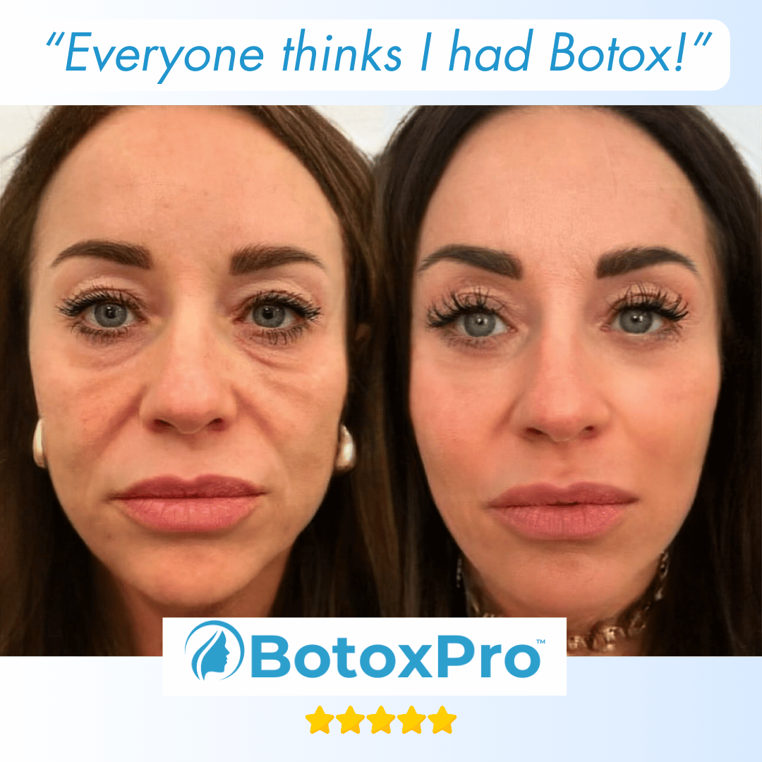 BotoxPRO Serum