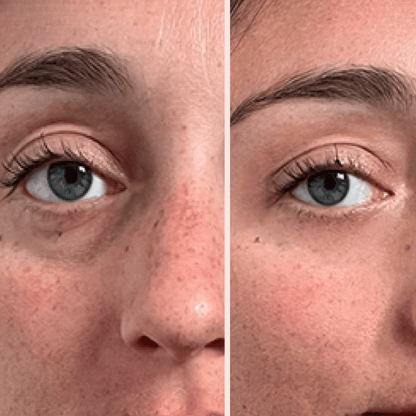 Peter, Thomas -  Extreme Instant Eye Firming Serum