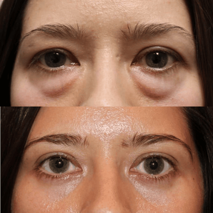 Peter, Thomas -  Extreme Instant Eye Firming Serum