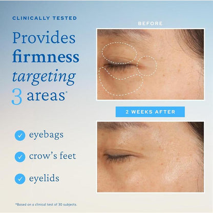 Aqua Bomb Eye Gel, Korean Skincare