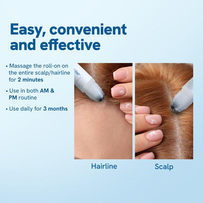 StemcellHair® - Advanced Hair Growth Roll-On Serum