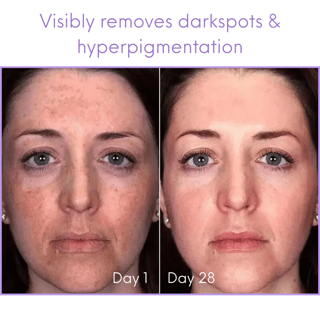 LaLavéa Darkspot-Corrector