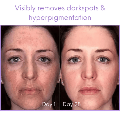 LaLavéa Darkspot-Corrector
