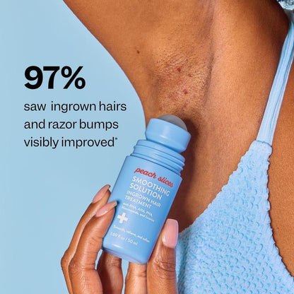 Anti Breakout: Skin Smoothing Roller