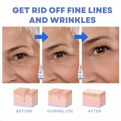 Samui | FACELIFT Botoxserum C