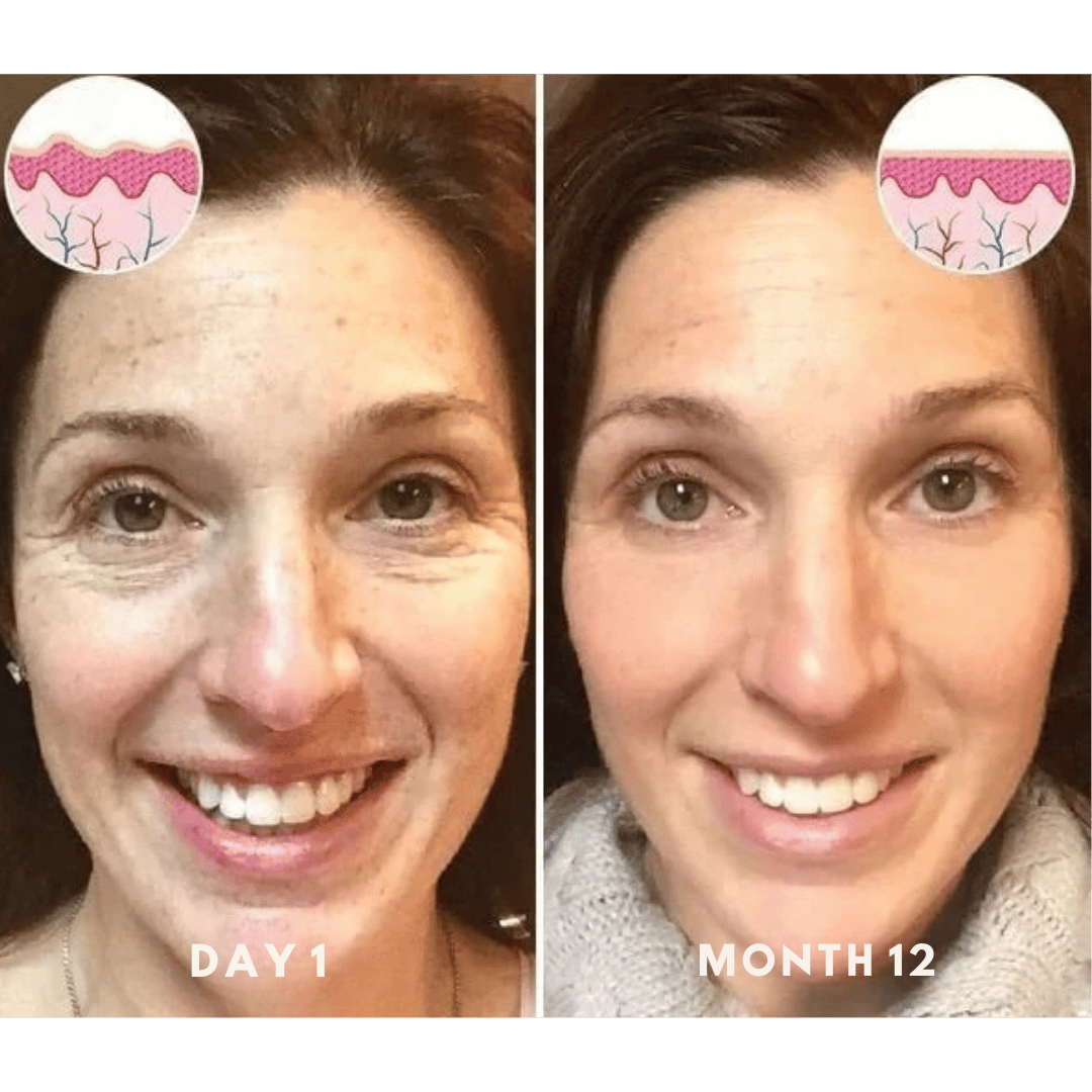 Samui | FACELIFT Botoxserum C