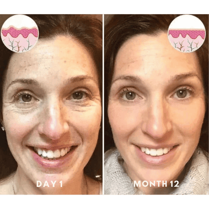 Samui | FACELIFT Botoxserum C