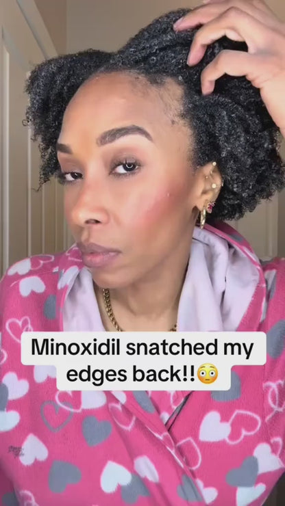 StemcellHair® - Advanced Hair Growth Roll-On Serum